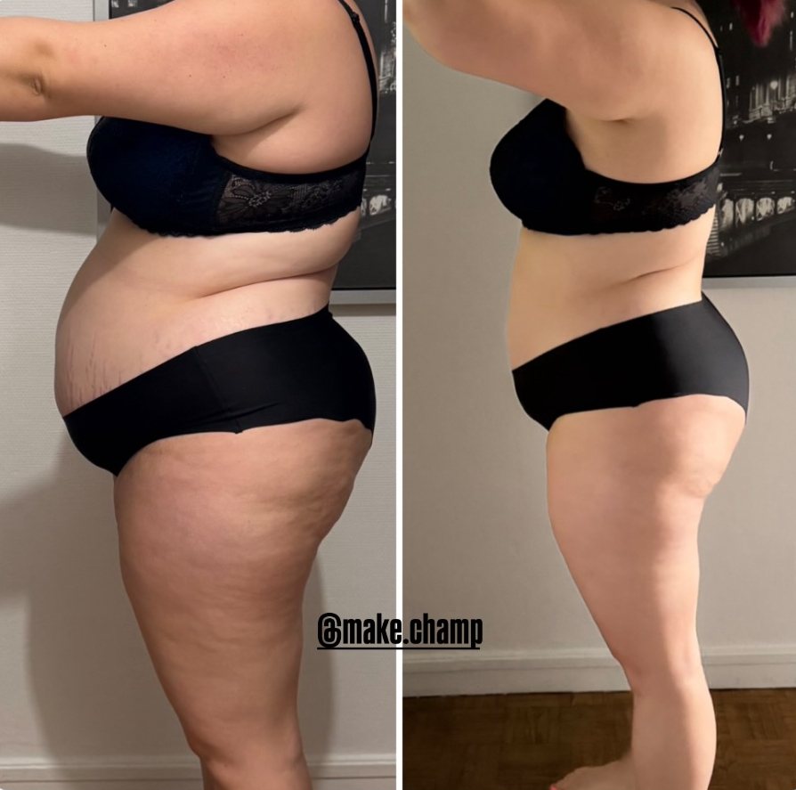 Transformation