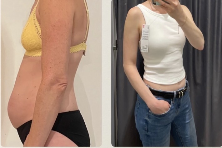 Transformation