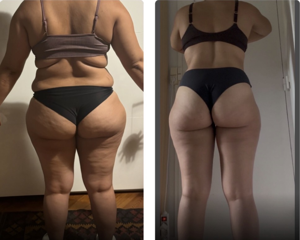Transformation
