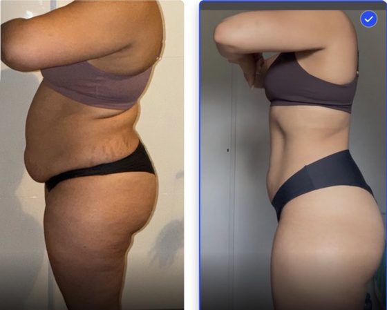 Transformation avant apres d'une participante