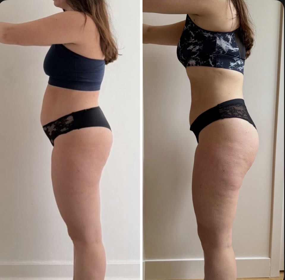 Transformation
