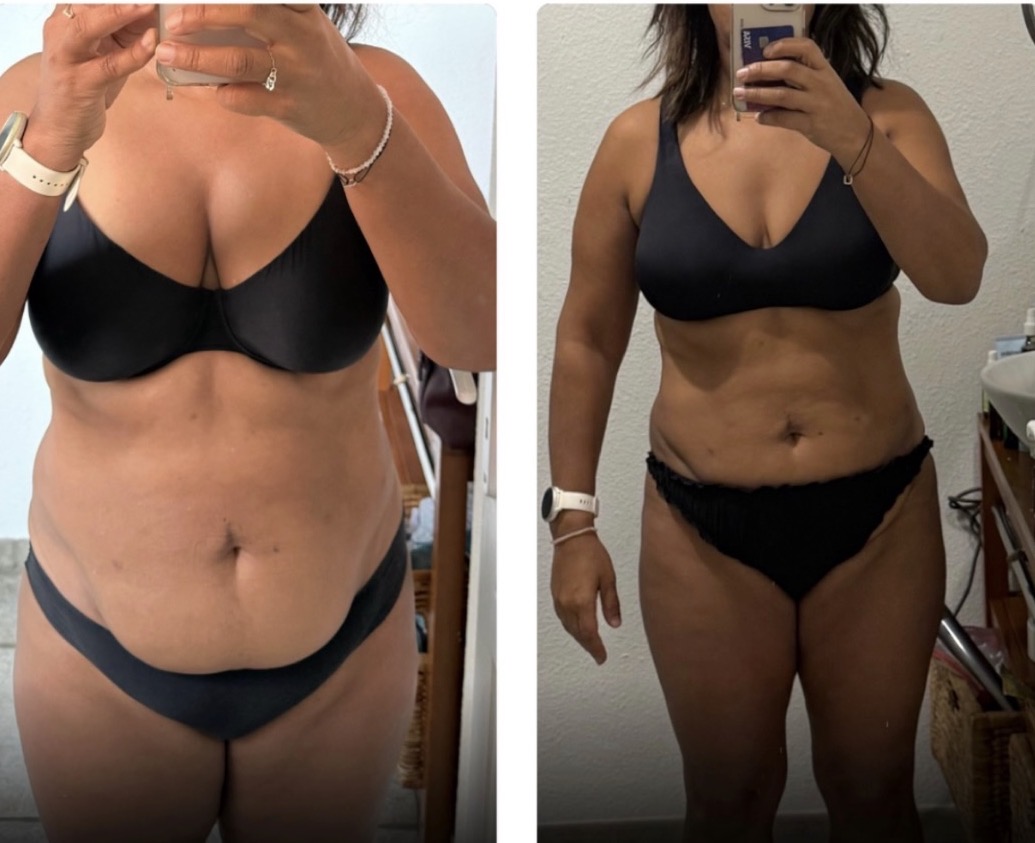 Transformation