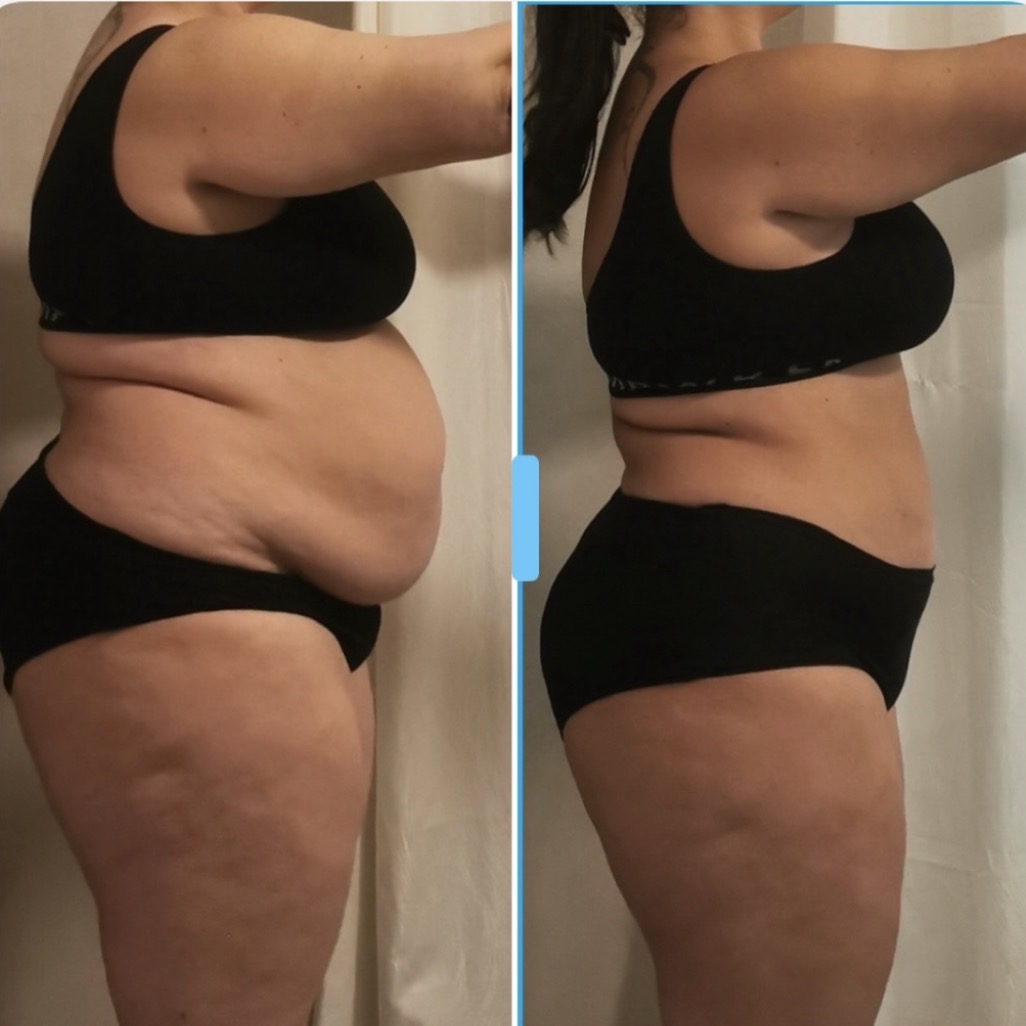 Transformation