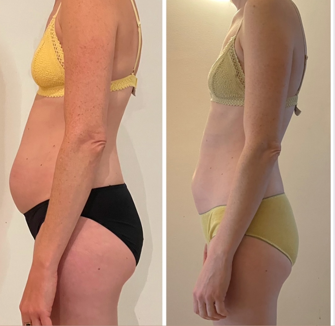 Transformation