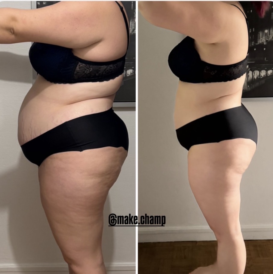 Transformation